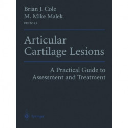 Articular Cartilage Lesions: A Practical Guide to Assessment and Treatment