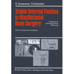 Stable Internal Fixation in Maxillofacial Bone Surgery: A Manual for Operating Room Personnel