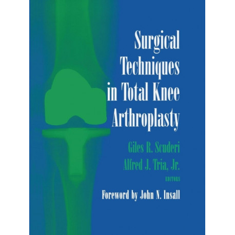 Surgical Techniques in Total Knee Arthroplasty