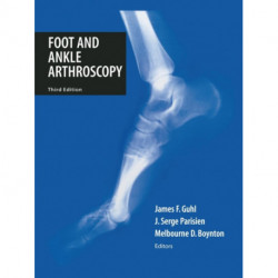 Foot and Ankle Arthroscopy
