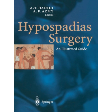 Hypospadias Surgery: An Illustrated Guide