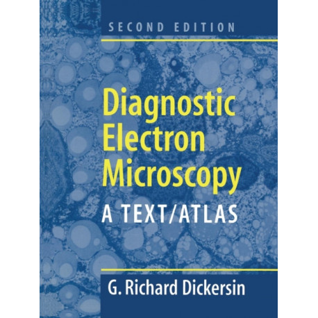 Diagnostic Electron Microscopy: A Text/Atlas