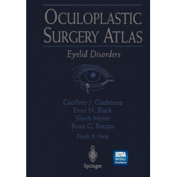 Oculoplastic Surgery Atlas: Eyelid Disorders