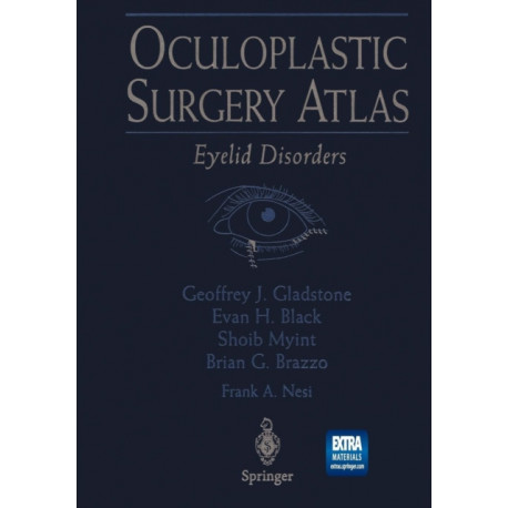 Oculoplastic Surgery Atlas: Eyelid Disorders