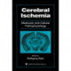 Cerebral Ischemia: Molecular and Cellular Pathophysiology