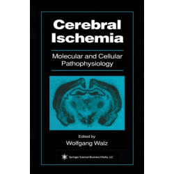 Cerebral Ischemia: Molecular and Cellular Pathophysiology