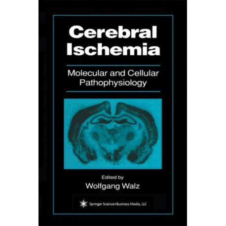 Cerebral Ischemia: Molecular and Cellular Pathophysiology