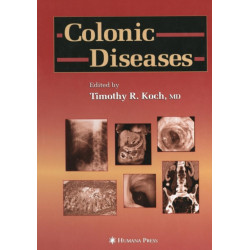 Colonic Diseases