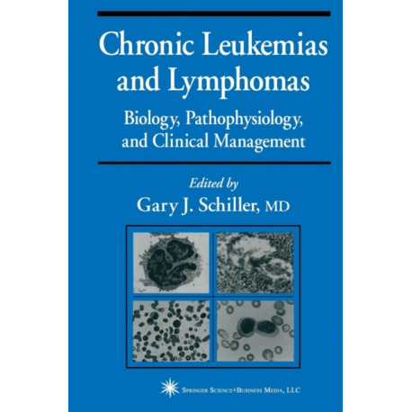 Chronic Leukemias and Lymphomas: Biology, Pathophysiology, and Clinical Management