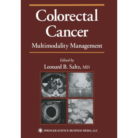 Colorectal Cancer: Multimodality Management