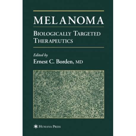 Melanoma: Biologically Targeted Therapeutics