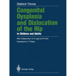 Congenital Dysplasia and Dislocation of the Hip in Children and Adults