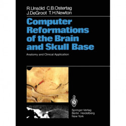 Computer Reformations of the Brain and Skull Base: Anatomy and Clinical Application