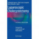 Laparoscopic Cholecystectomy: An Evidence-Based Guide