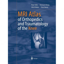MRI Atlas of Orthopedics and Traumatology of the Knee