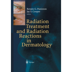 Radiation Treatment and Radiation Reactions in Dermatology