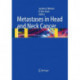 Metastases in Head and Neck Cancer