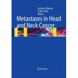 Metastases in Head and Neck Cancer