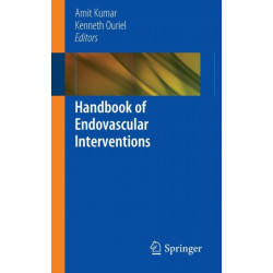 Handbook of Endovascular Interventions
