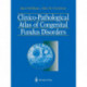 Clinico-Pathological Atlas of Congenital Fundus Disorders