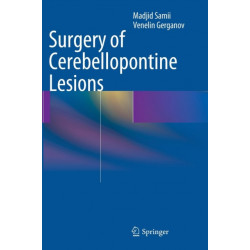 Surgery of Cerebellopontine Lesions
