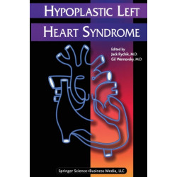 Hypoplastic Left Heart Syndrome
