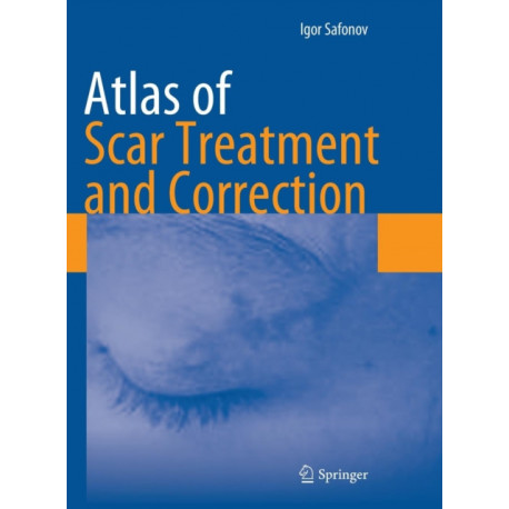 Atlas of Scar Treatment and Correction