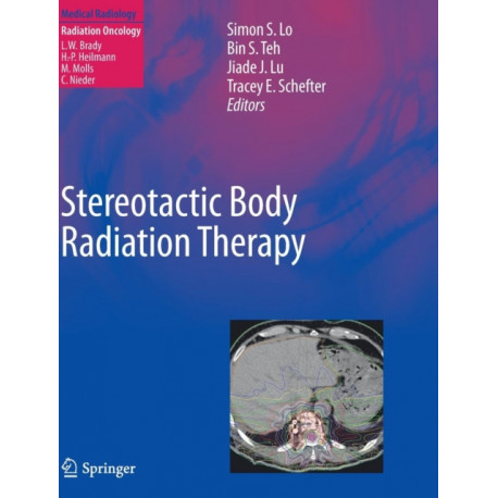 Stereotactic Body Radiation Therapy