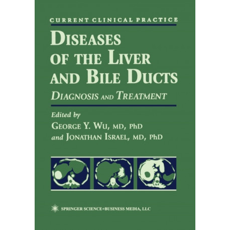 Diseases of the Liver and Bile Ducts: A Practical Guide to Diagnosis and Treatment