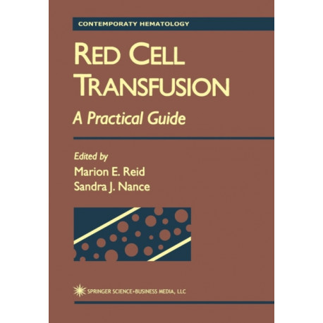 Red Cell Transfusion: A Practical Guide