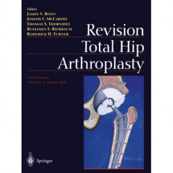 Revision Total Hip Arthroplasty