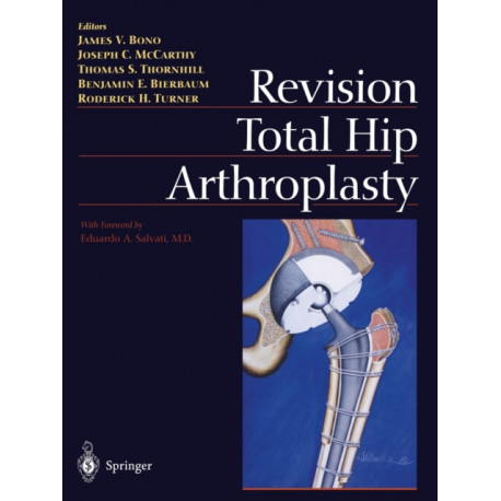 Revision Total Hip Arthroplasty