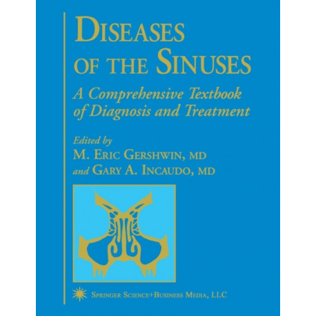 Diseases of the Sinuses: A Comprehensive Textbook of Diagnosis and Treatment