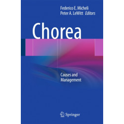 Chorea: Causes and Management