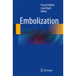 Embolization
