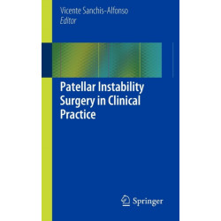 Patellar Instability Surgery in Clinical Practice
