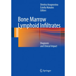 Bone Marrow Lymphoid Infiltrates: Diagnosis and Clinical Impact