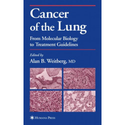 Cancer of the Lung: From Molecular Biology to Treatment Guidelines