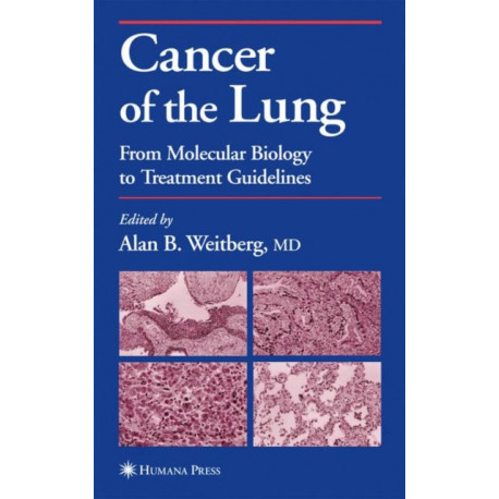 Cancer of the Lung: From Molecular Biology to Treatment Guidelines
