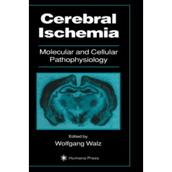 Cerebral Ischemia: Molecular and Cellular Pathophysiology