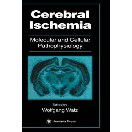 Cerebral Ischemia: Molecular and Cellular Pathophysiology