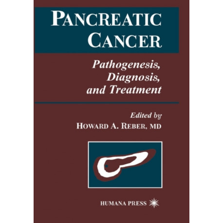 Pancreatic Cancer: Pathogenesis, Diagnosis, and Treatment