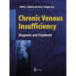 Chronic Venous Insufficiency: Diagnosis and Treatment