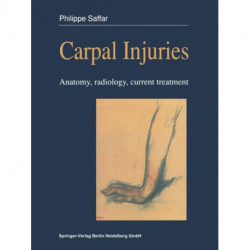 Carpal injuries: Anatomy, radiology, current treatment