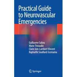 Practical Guide to Neurovascular Emergencies