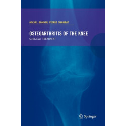 Osteoarthritis of the knee