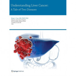 Understanding Liver Cancer: A Tale of Two Diseases
