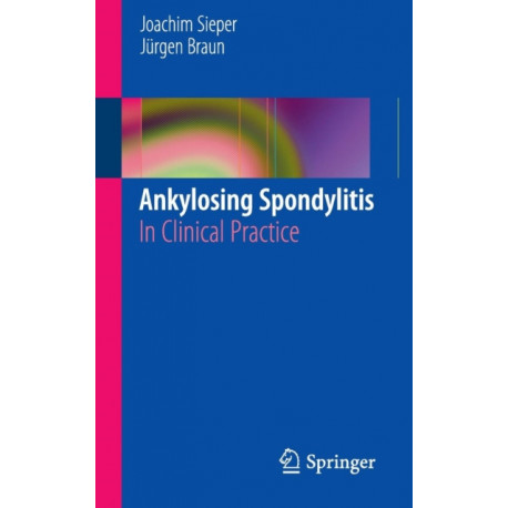 Ankylosing Spondylitis: In Clinical Practice