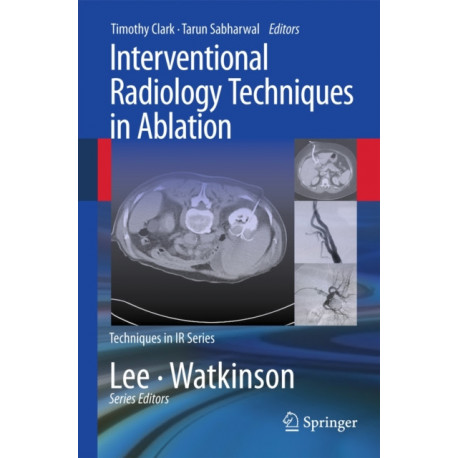 Interventional Radiology Techniques in Ablation