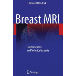 Breast MRI: Fundamentals and Technical Aspects